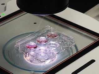 日本ブレイディの事例1